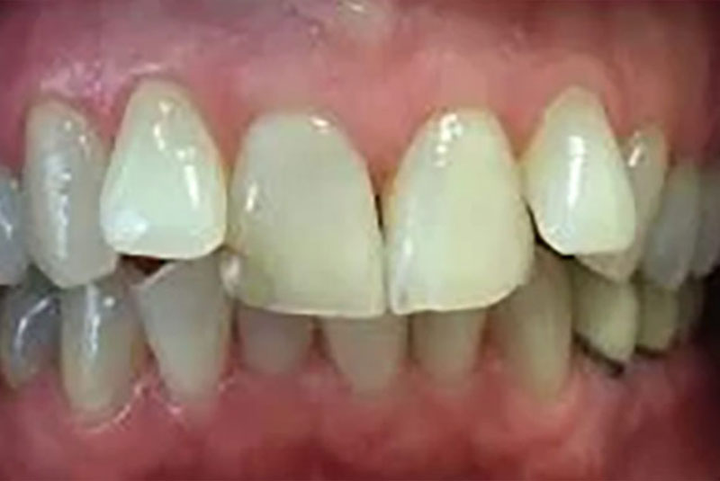 Before