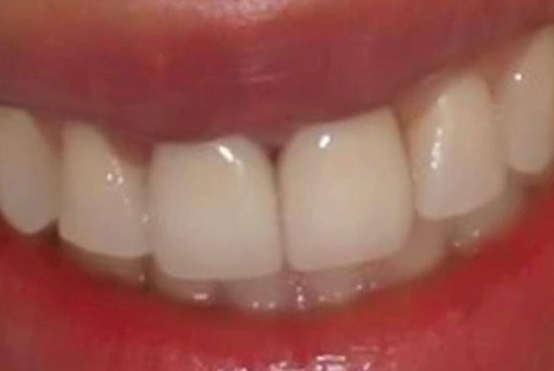 After