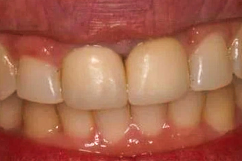 Before